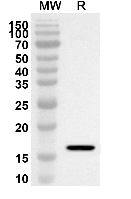 Anti-Human FABP5 Polyclonal Antibody binds to Recombinant Mouse FABP5 Protein, N-His in WB Assay