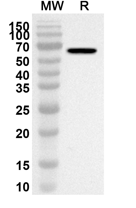 Anti-Human FBN2 Polyclonal Antibody binds to Recombinant Human FBN2, N-GST in WB Assay