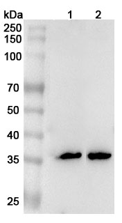 Anti-Human FCN1 Polyclonal Antibody binds to Recombinant Human FCN1 Protein, N-His in WB Assay