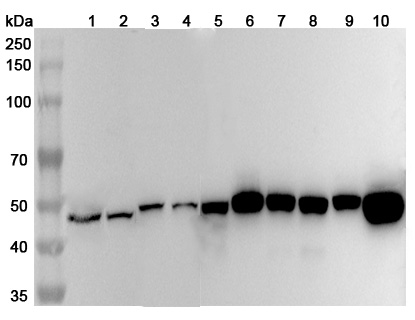 Anti-Human FEN1 Polyclonal Antibody binds to Recombinant Human FEN1 Protein, N-His in WB Assay