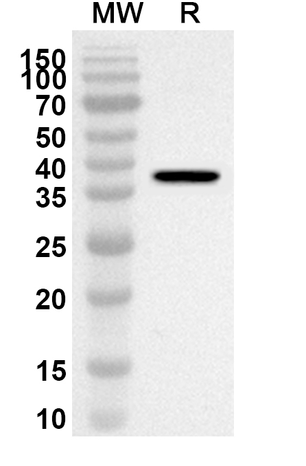 Anti-Human FERMT2 Polyclonal Antibody binds to Human FERMT2 Recombinant Protein, N-His in WB Assay