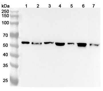 Anti-Human FGB/Fibrinogen beta Polyclonal Antibody binds to FGB, N-His, recombinant protein in WB Assay