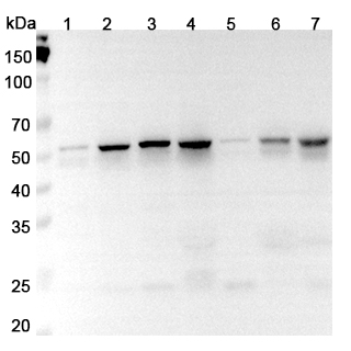 Anti-Human FLI1 Polyclonal Antibody binds to Recombinant Human FLI1, N-His in WB Assay