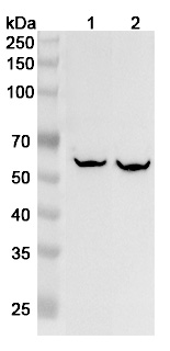 Anti-Human FTCD Polyclonal Antibody binds to Recombinant Human FTCD Protein, N-His in WB Assay