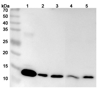 Anti-Human Gal-1/LGALS1 Polyclonal Antibody binds to Recombinant Human Gal-1/LGALS1 Protein, C-His in WB Assay