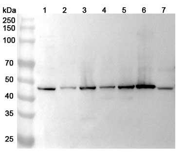 Anti-Human GALNS Polyclonal Antibody binds to Human GALNS Recombinant Protein, N-His in WB Assay