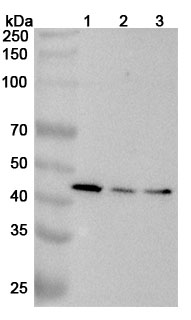 Anti-Human GALT Polyclonal Antibody in WB Assay