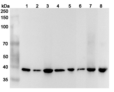 Anti-Human GIPC1 Polyclonal Antibody binds to Recombinant Human GIPC1 Protein, N-His in WB Assay