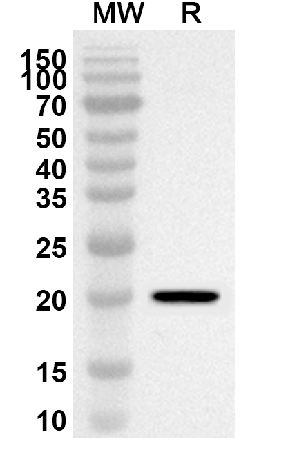 Anti-Human GKN2 Polyclonal Antibody binds to Recombinant Human GKN2, N-His in WB Assay