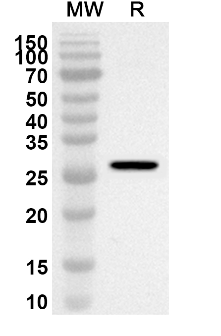 Anti-Human GLI3 Polyclonal Antibody binds to Recombinant Human GLI3, N-His in WB Assay