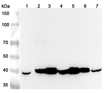 Anti-Human GNAQ Polyclonal Antibody binds to Recombinant Human GNAQ Protein, N-His in WB Assay