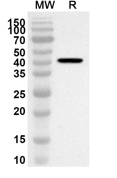 Anti-Human GPT2 Polyclonal Antibody binds to Recombinant Human GPT2, N-His in WB Assay