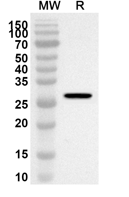Anti-Human GPX2 Polyclonal Antibody binds to Human GPX2 Recombinant Protein, N-His in WB Assay