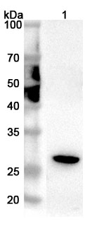 Anti-Human GPX5 Polyclonal Antibody binds to Recombinant Human GPX5 Protein, N-His in WB Assay