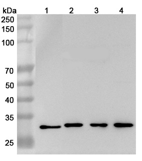 Anti-Human GSTO1 Polyclonal Antibody binds to Recombinant Human GSTO1 Protein, N-His in WB Assay