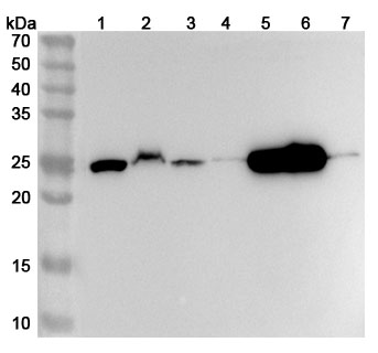 Anti-Human GSTT1 Polyclonal Antibody binds to Recombinant Human GSTT1 Protein, N-His in WB Assay