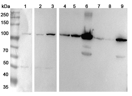 Anti-Human HADHA Polyclonal Antibody binds to Recombinant Human HADHA Protein, N-His in WB Assay