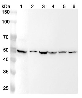 Anti-Human HAPLN1 Polyclonal Antibody binds to Recombinant Human HAPLN1 Protein, N-His in WB Assay
