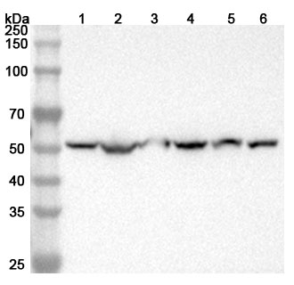 Anti-Human HARS1/jo-1 Antibody (SAA2345) binds to Human HARS1 Recombinant Protein, N-His in WB Assay