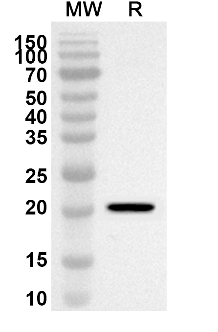Anti-Human HLTF Polyclonal Antibody binds to Recombinant Human HLTF, N-His in WB Assay