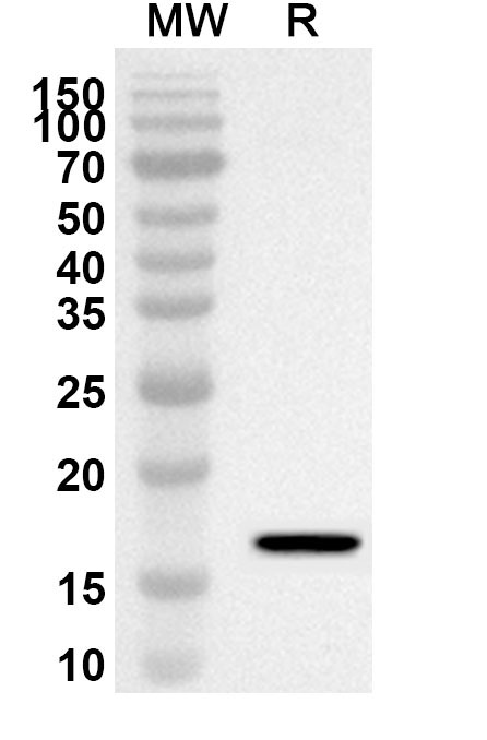Anti-Human HNF1B Polyclonal Antibody binds to Recombinant Human HNF1B, N-His in WB Assay