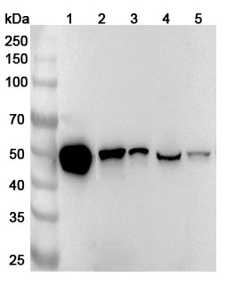 Anti-Human HNRNPH1 (Gly10-His194) Polyclonal Antibody binds to Human HNRNPH1 Recombinant Protein, N-His in WB Assay