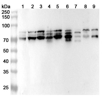 Anti-Human HNRNPR Polyclonal Antibody binds to Recombinant Human HNRNPR Protein, N-His in WB Assay