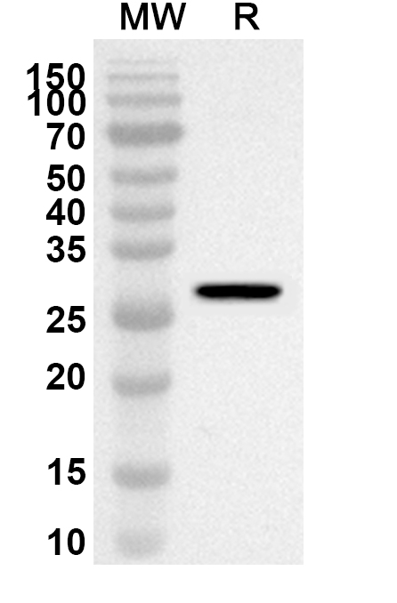 Anti-Human HNRNPU Polyclonal Antibody binds to Recombinant Human HNRNPU Protein, N-His in WB Assay