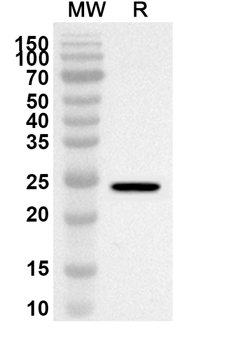 Anti-Human HPS5 Polyclonal Antibody binds to Human HPS5 Recombinant Protein, N-His in WB Assay