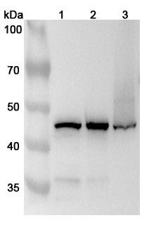Anti-Human HSDL2 Polyclonal Antibody binds to Recombinant Human HSDL2 Protein, N-His in WB Assay