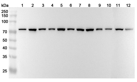 Anti-Human HSPA8 Polyclonal Antibody binds to HSPA8, N-His, recombinant protein in WB Assay