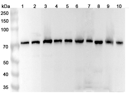 Anti-Human HSPA9/Mortalin/GRP75 Polyclonal Antibody binds to Recombinant Human HSPA9, N-His in WB Assay
