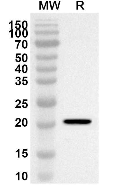 Anti-Human HSPB8 Polyclonal Antibody binds to Recombinant Human HSPB8 Protein, N-His-SUMO in WB Assay