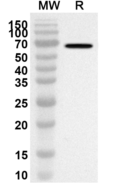 Anti-Human IARS1 Polyclonal Antibody binds to Recombinant Human IARS1 Protein, N-His in WB Assay