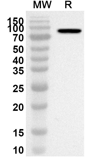 Anti-Human IFIT2 Polyclonal Antibody binds to Recombinant Human IFIT2 Protein, N-GST & C-His in WB Assay