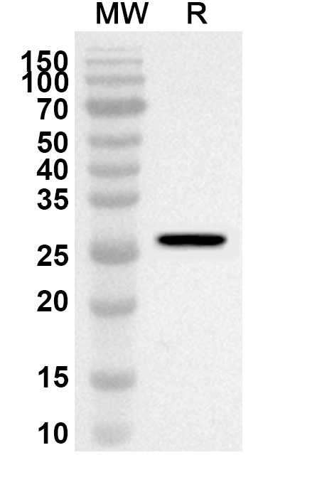 Anti-Human IFITM5 Polyclonal Antibody in WB Assay