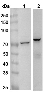Anti-Human IGF2BP1 Polyclonal Antibody binds to Recombinant Human IGF2BP1 Protein, N-His in WB Assay