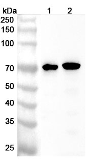 Anti-Human IKZF3 Polyclonal Antibody binds to Recombinant Human IKZF3 Protein, N-His in WB Assay