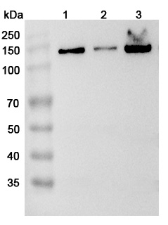 Anti-Human IPO4 Polyclonal Antibody binds to Recombinant Human IPO4 Protein, N-His in WB Assay