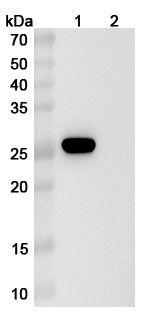 Anti-Human ITM2A Antibody (SAA2350) binds to Human ITM2A Recombinant Protein, N-His in WB Assay