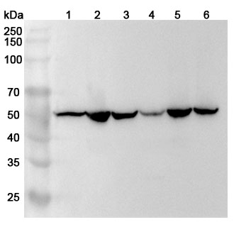Anti-Human jo-1 Polyclonal Antibody in WB Assay