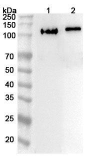 Anti-Human KIF18A Polyclonal Antibody binds to Recombinant Human KIF18A Protein, N-His in WB Assay