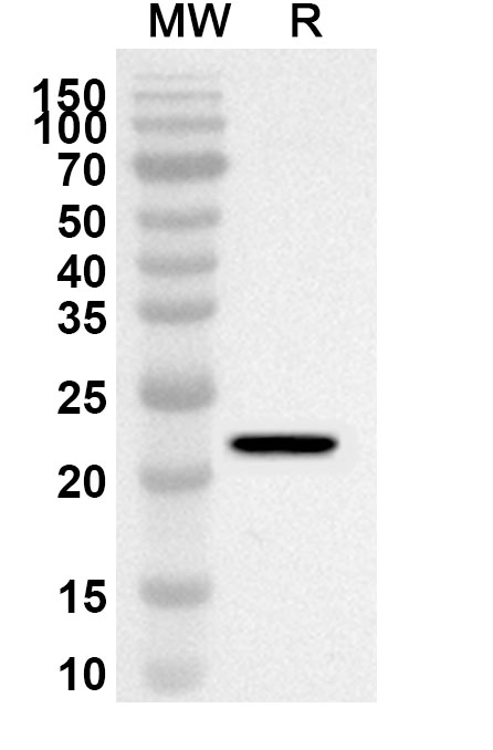 Anti-Human LAMA5 Polyclonal Antibody binds to Recombinant Human LAMA5, N-His in WB Assay