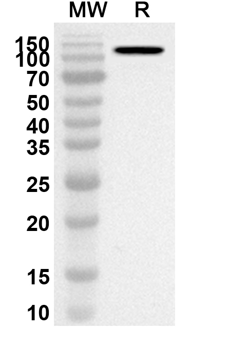 Anti-Human LAMC2 Polyclonal Antibody binds to Recombinant Human LAMC2 Protein, N-His in WB Assay