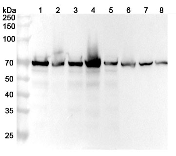 Anti-Human LCP1 Polyclonal Antibody binds to Recombinant Human LCP1 Protein, N-His in WB Assay