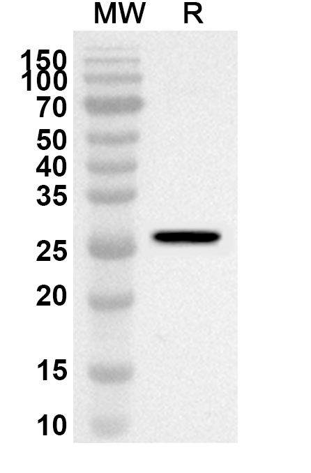Anti-Human LHCGR Polyclonal Antibody binds to Recombinant Human LHCGR Protein, N-His in WB Assay