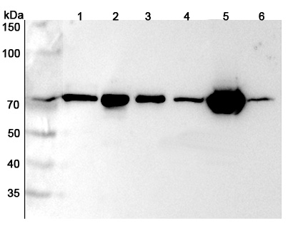 Anti-Human LMNB2 Polyclonal Antibody binds to Human LMNB2 Recombinant Protein, N-His in WB Assay