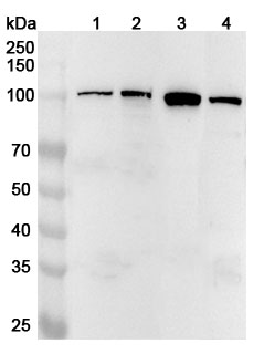 Anti-Human LONP1 Polyclonal Antibody binds to Human LONP1 Recombinant Protein, N-His in WB Assay