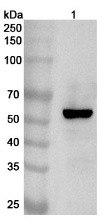 Anti-Human LPCAT1 Polyclonal Antibody binds to Human LPCAT1 Recombinant Protein, N-His in WB Assay