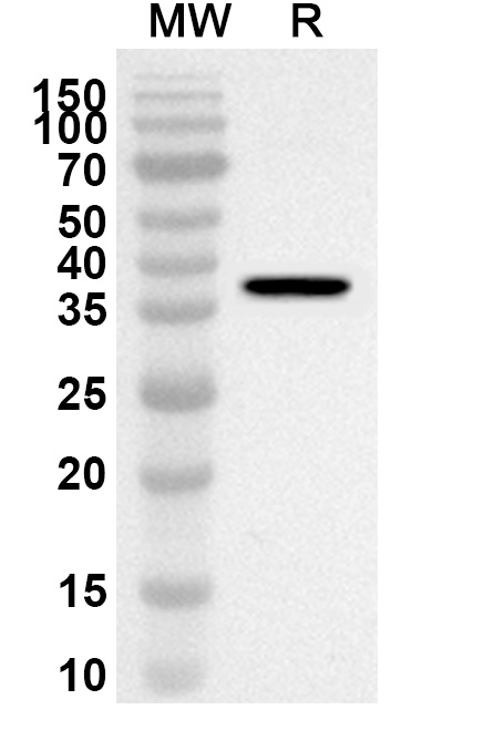 Anti-Human LRIG1 Polyclonal Antibody binds to Mouse LRIG1 Recombinant Protein, C-His in WB Assay